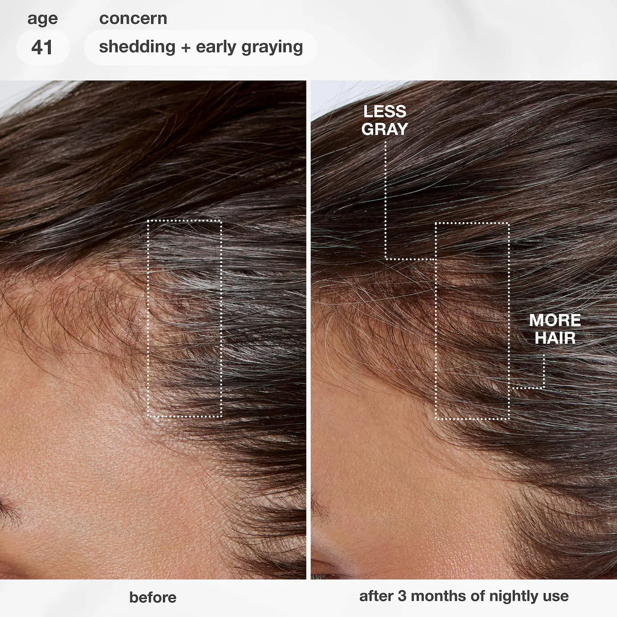 K18 Biomimetic Hairscience - FutureIQ™ biomimetic hair longevity serum | 90 mL