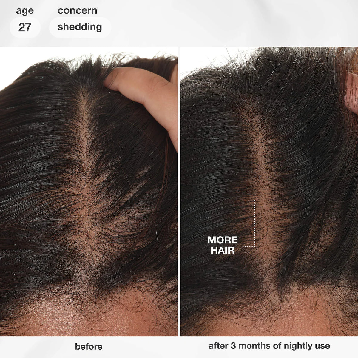 K18 Biomimetic Hairscience - FutureIQ™ biomimetic hair longevity serum | 90 mL