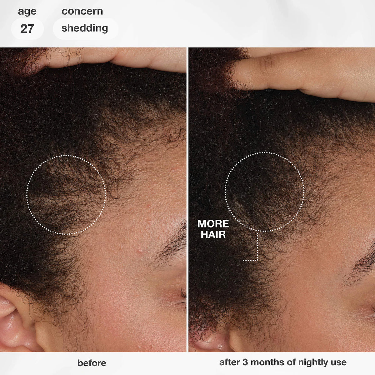 K18 Biomimetic Hairscience - FutureIQ™ biomimetic hair longevity serum | 90 mL