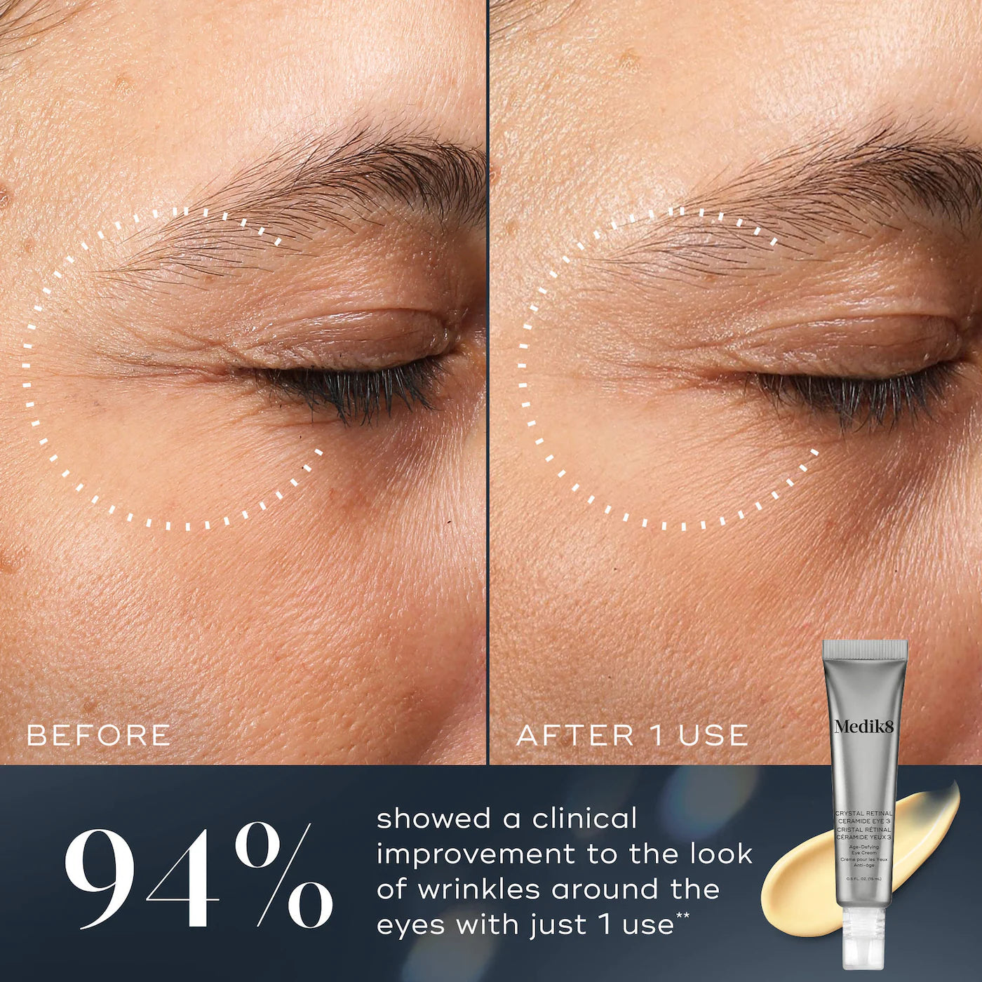 Medik8 - Crystal Retinal® Ceramide Eye 6 | 15 mL