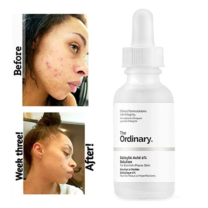 Ordinary salicylic acid deals serum