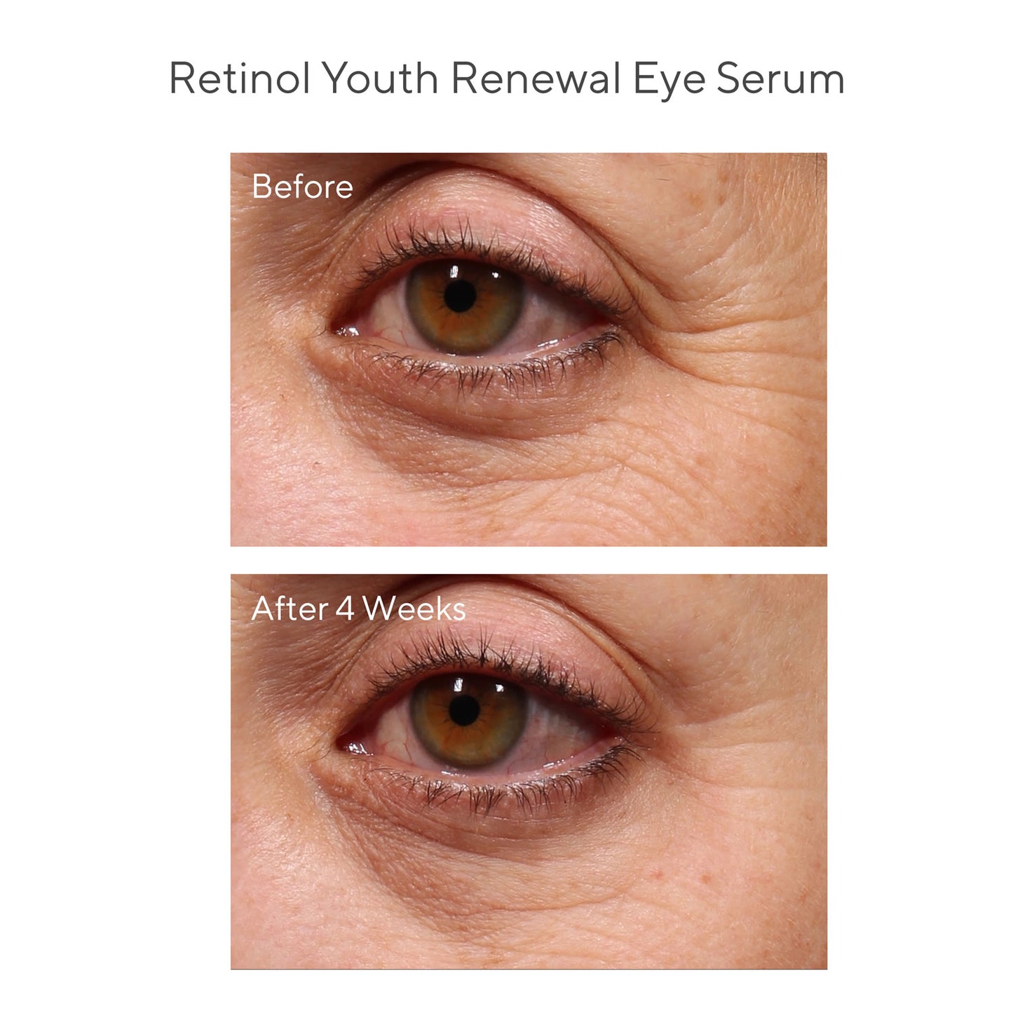 Murad - The Derm Report on: Results With Retinol Value Kit