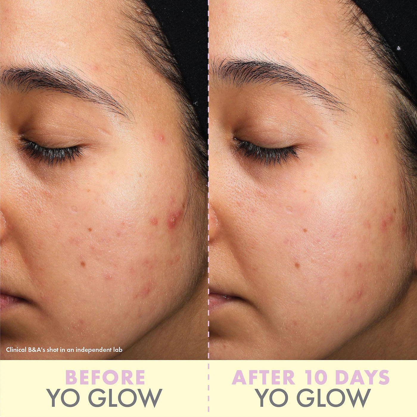 Wishful - Yo Glow AHA & BHA Facial Enzyme Scrub | 100 mL